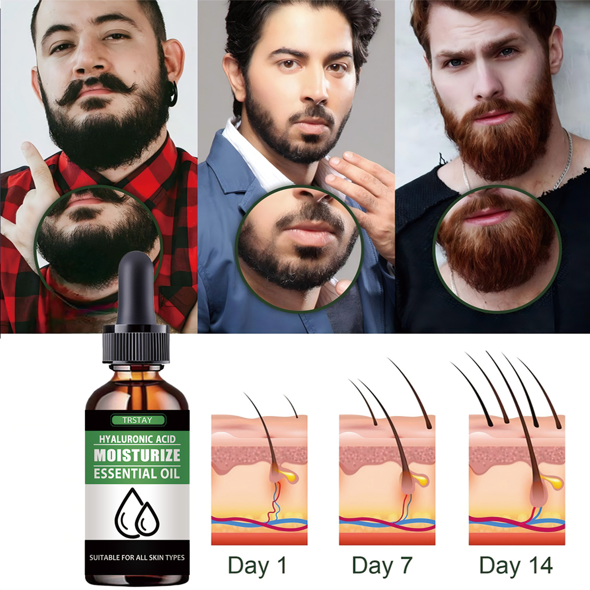 100% طبيعي تسريع شعر الوجه تنم - مراجعة Men'S Grooming Essentials وسعره